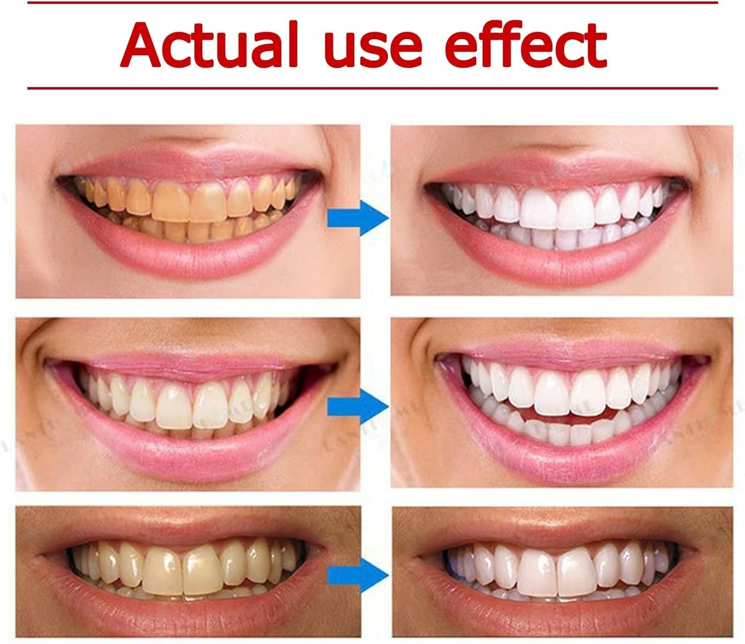 Yayashi SP-4 Ultra Whitening Toothpaste – 150ml Probiotic Stain Remover for Bright, Healthy Teeth - Image 5