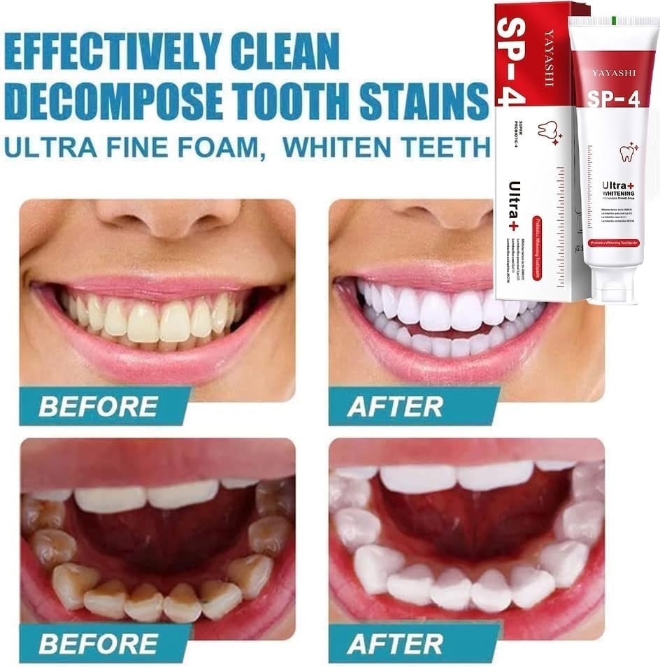Yayashi SP-4 Ultra Whitening Toothpaste – 150ml Probiotic Stain Remover for Bright, Healthy Teeth - Image 4